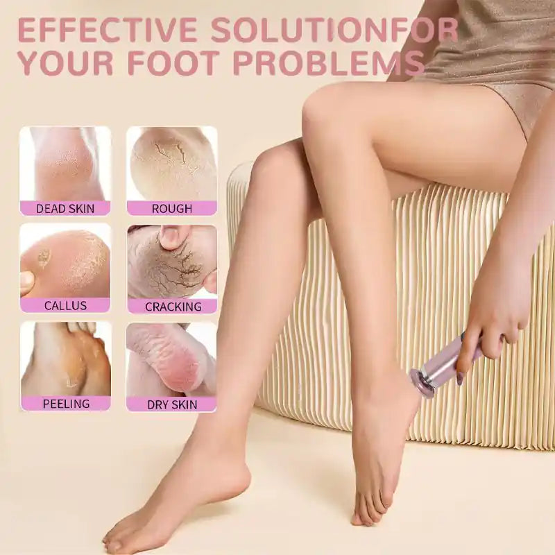 Electric foot grinding and skin peeling artifact