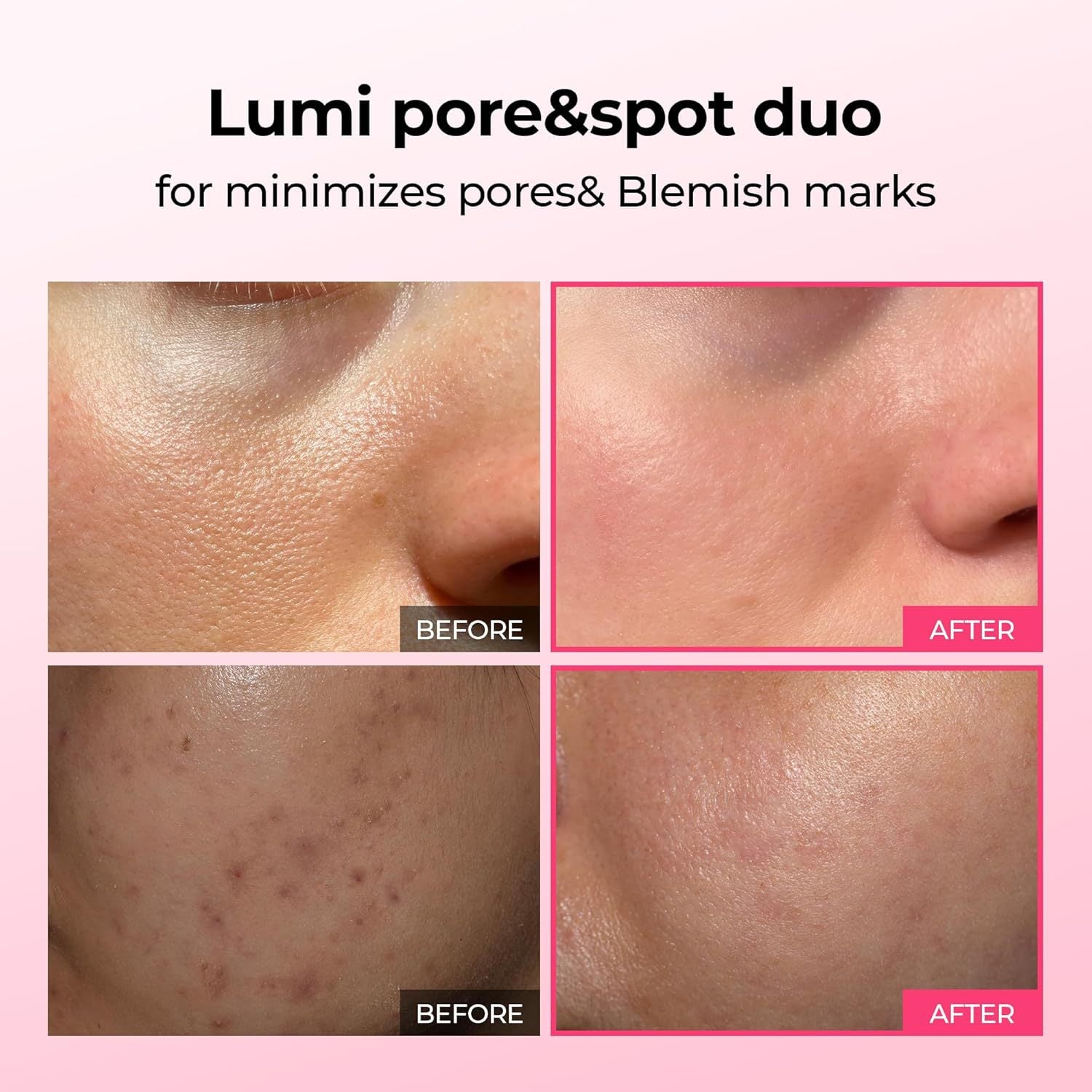 Pink Spicule Serum with Calcium Hydrating Set ? Deep Hydration, Skin Renewal, Collagen Boost, Smooth Glass Skin Glow Treatment