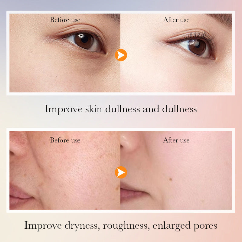 SADOER Vitamin C Whitening Skin Care Gift Box