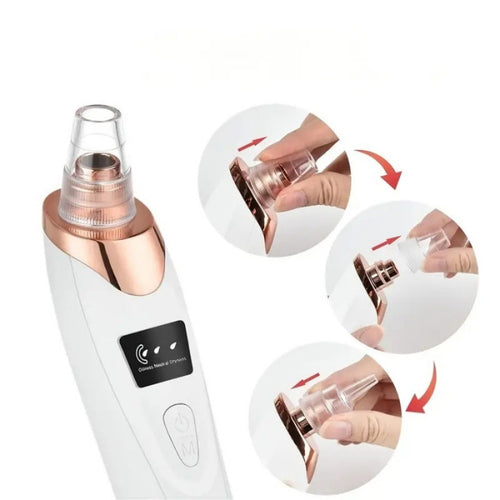 Blackhead Removal Device
